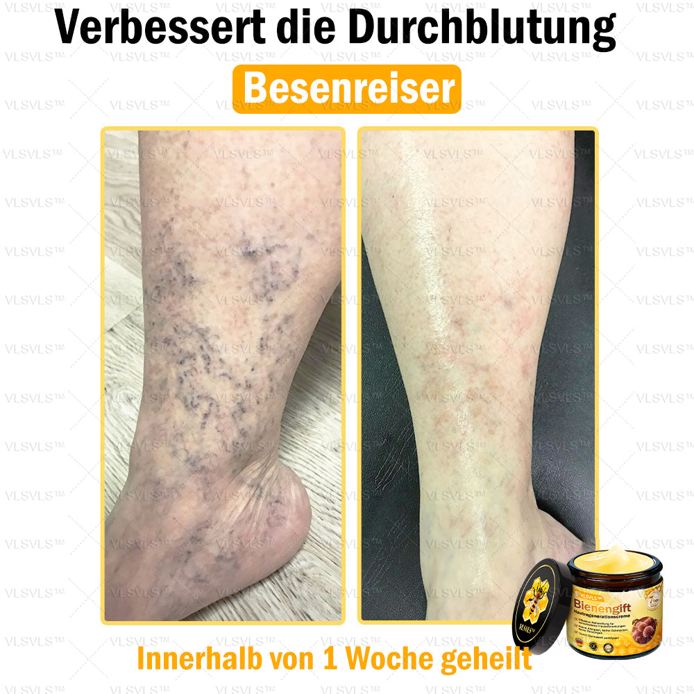 ⛄🎁 Nur noch 5 Dosen auf Lager! Wir bieten Ihnen zusätzlich 30 % Rabatt an! Bringen Sie sich in Form und bleiben Sie gesund. Wenn Sie jetzt nicht zugreifen, haben Sie erst nächstes Jahr wieder eine Chance!