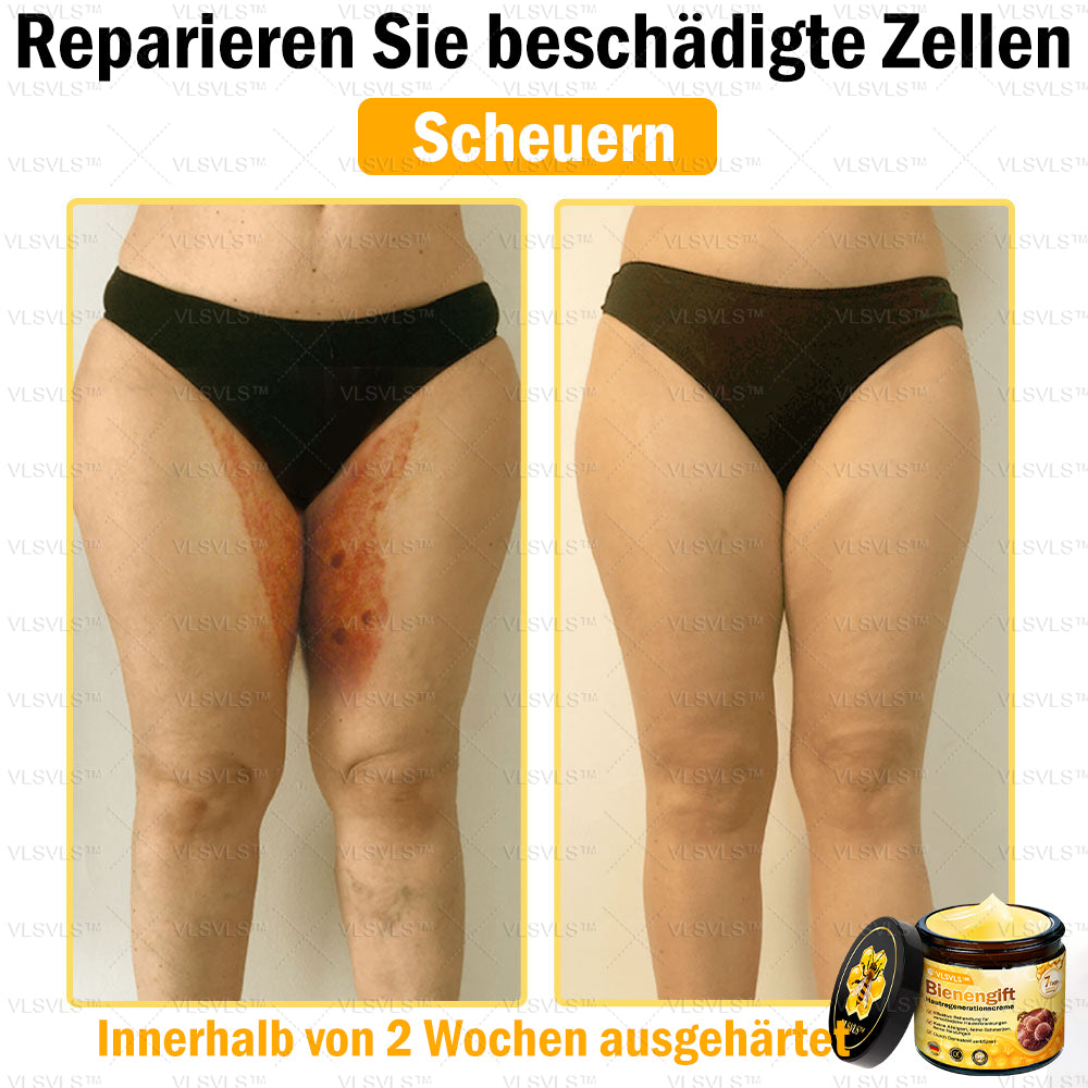 ⛄🎁 Nur noch 5 Dosen auf Lager! Wir bieten Ihnen zusätzlich 30 % Rabatt an! Bringen Sie sich in Form und bleiben Sie gesund. Wenn Sie jetzt nicht zugreifen, haben Sie erst nächstes Jahr wieder eine Chance!