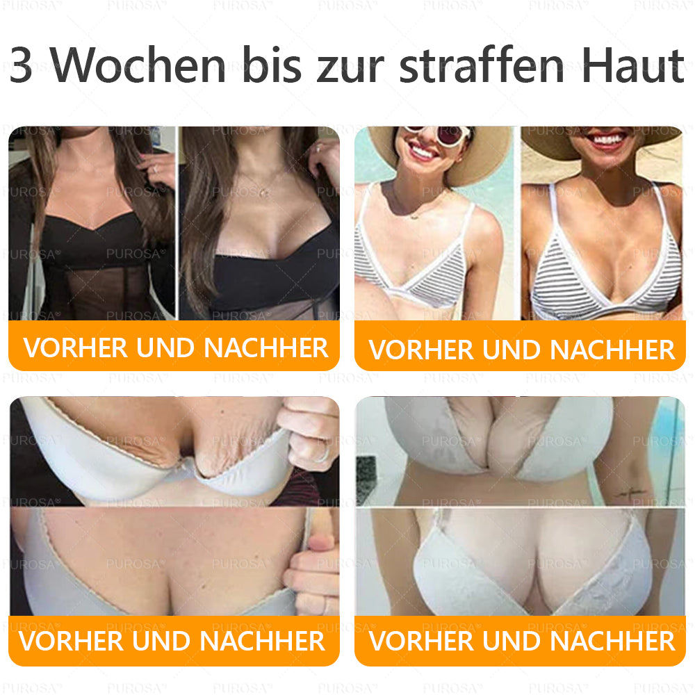 Hergestellt und versendet aus Deutschland ✨ VLSVLS® Bienengift Hautregenerationscreme 🔥 LETZTER TAG 80 % RABATT🌟🌟