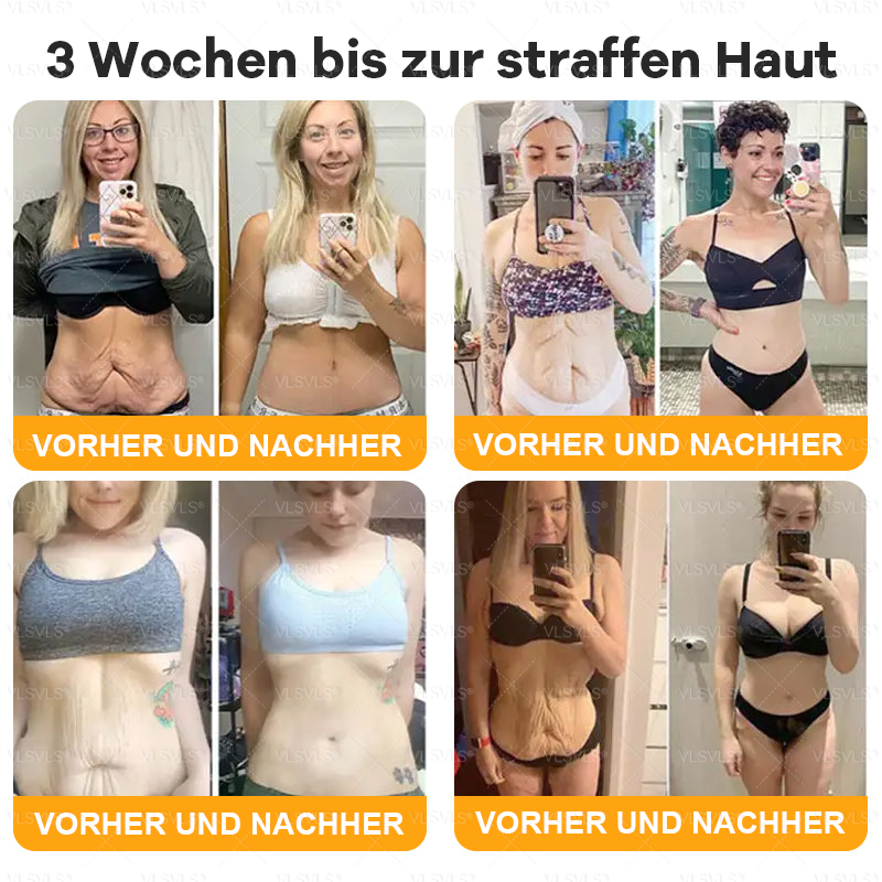 Hergestellt und versendet aus Deutschland ✨ VLSVLS® Bienengift Hautregenerationscreme 🔥 LETZTER TAG 80 % RABATT🌟