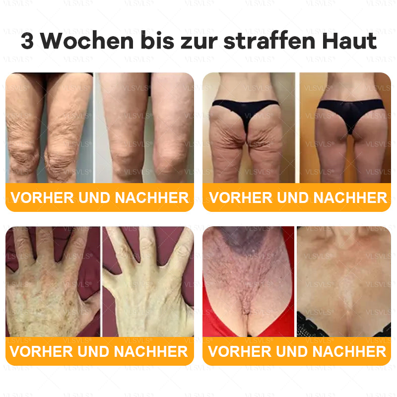 Hergestellt und versendet aus Deutschland ✨ VLSVLS® Bienengift Hautregenerationscreme 🔥 LETZTER TAG 80 % RABATT🌟
