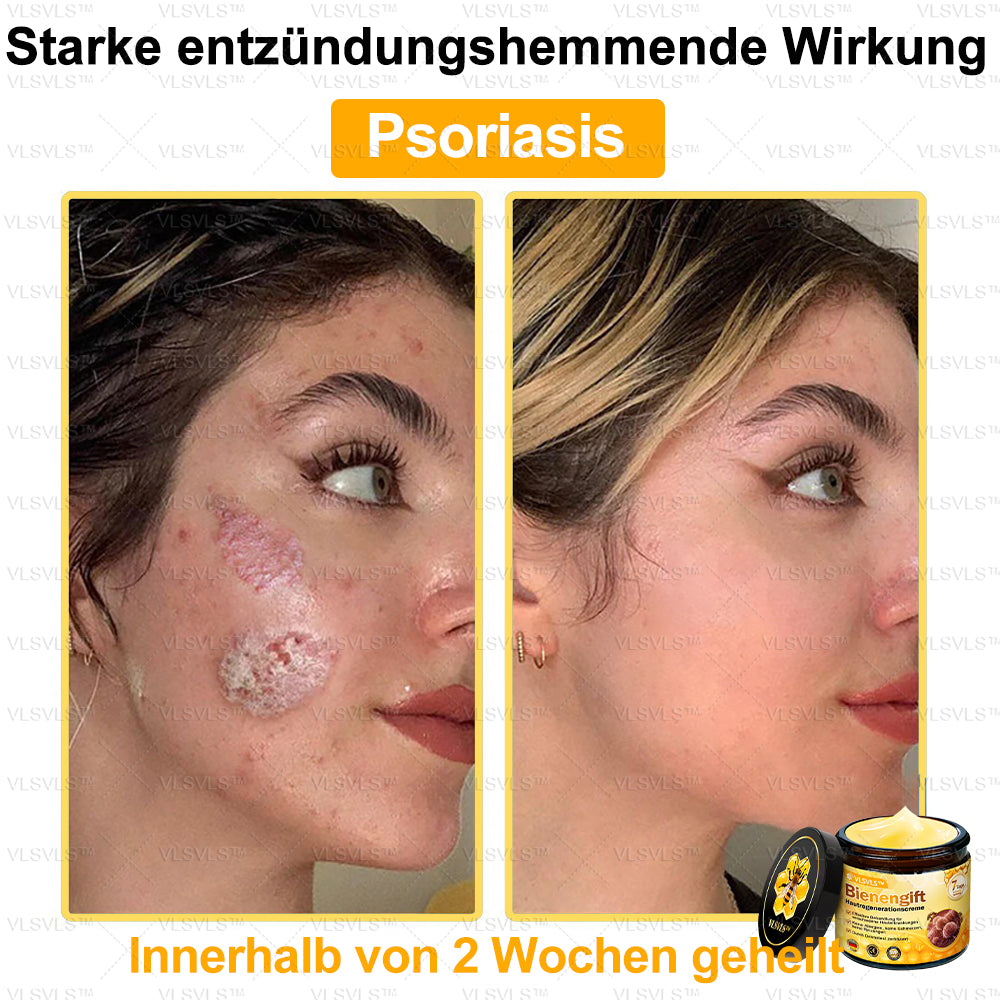 ⛄🎁 Nur noch 5 Dosen auf Lager! Wir bieten Ihnen zusätzlich 30 % Rabatt an! Bringen Sie sich in Form und bleiben Sie gesund. Wenn Sie jetzt nicht zugreifen, haben Sie erst nächstes Jahr wieder eine Chance!