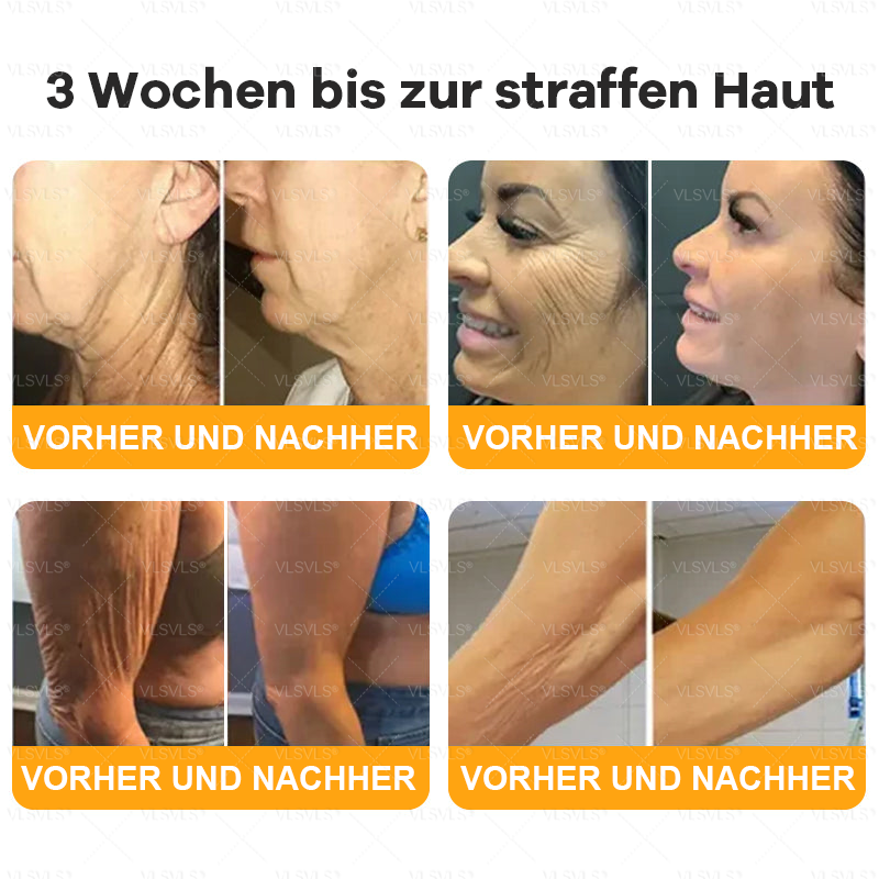 Hergestellt und versendet aus Deutschland ✨ VLSVLS® Bienengift Hautregenerationscreme 🔥 LETZTER TAG 80 % RABATT🌟