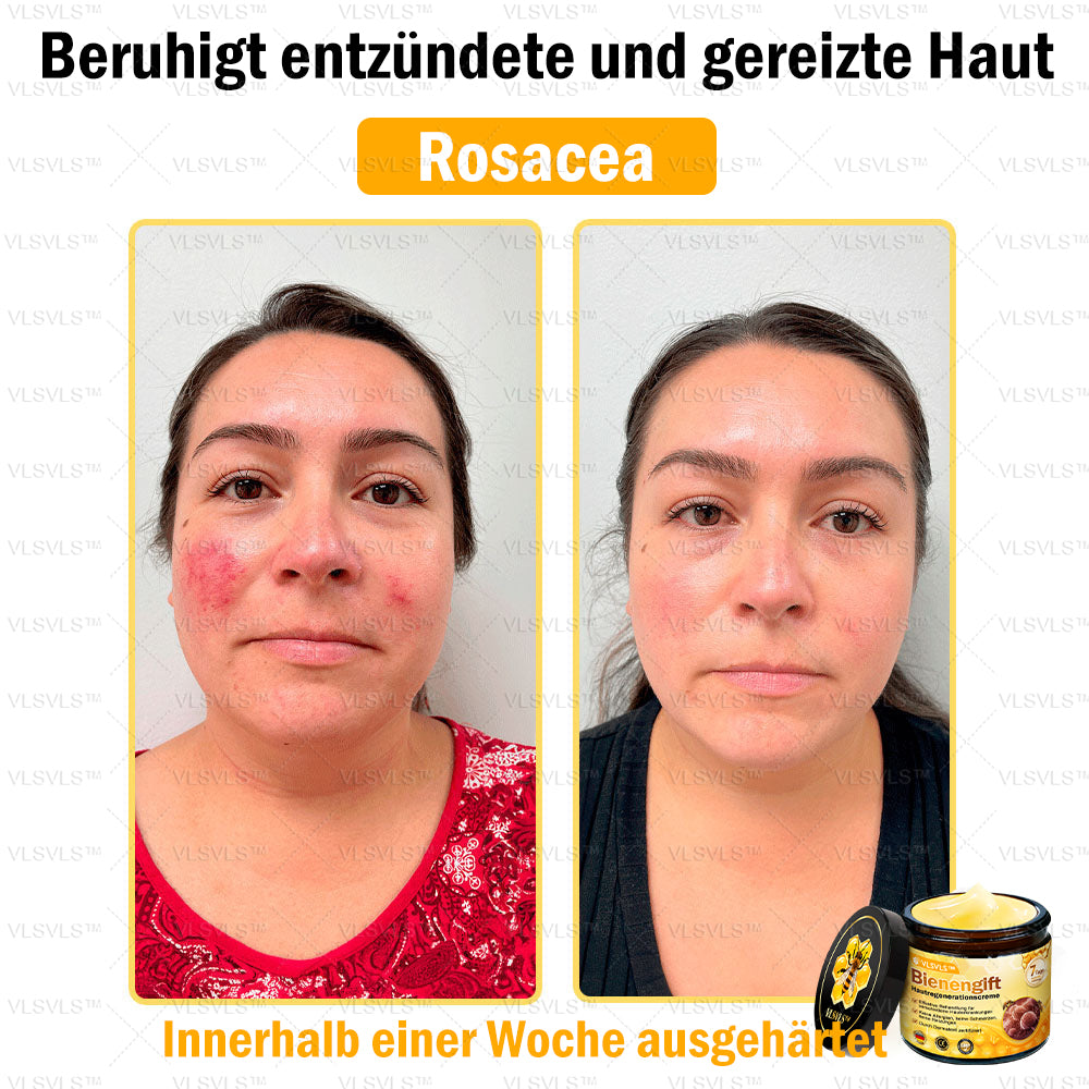 ⛄🎁 Nur noch 5 Dosen auf Lager! Wir bieten Ihnen zusätzlich 30 % Rabatt an! Bringen Sie sich in Form und bleiben Sie gesund. Wenn Sie jetzt nicht zugreifen, haben Sie erst nächstes Jahr wieder eine Chance!