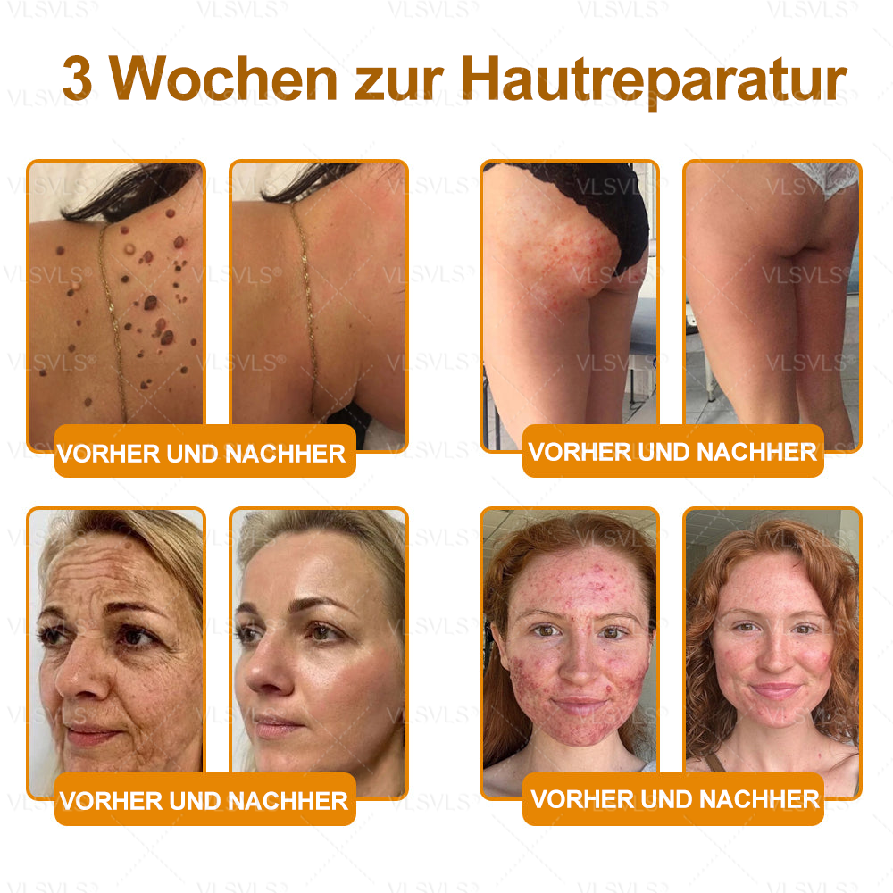 Hergestellt und versendet aus Deutschland ✨ VLSVLS® Bienengift Hautregenerationscreme 🔥 LETZTER TAG 80 % RABATT🌟🌟