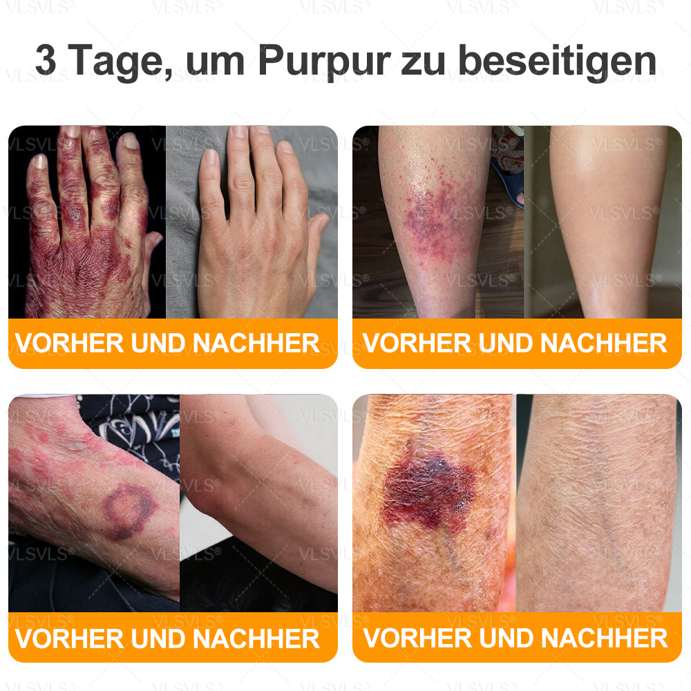 Hergestellt und versendet aus Deutschland ✨ VLSVLS® Bienengift Hautregenerationscreme 🔥 LETZTER TAG 80 % RABATT🌟🌟