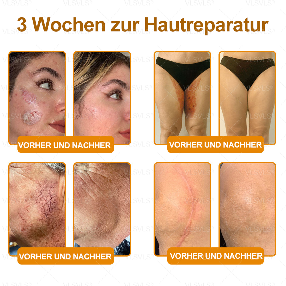 Hergestellt und versendet aus Deutschland ✨ VLSVLS® Bienengift Hautregenerationscreme 🔥 LETZTER TAG 80 % RABATT🌟🌟
