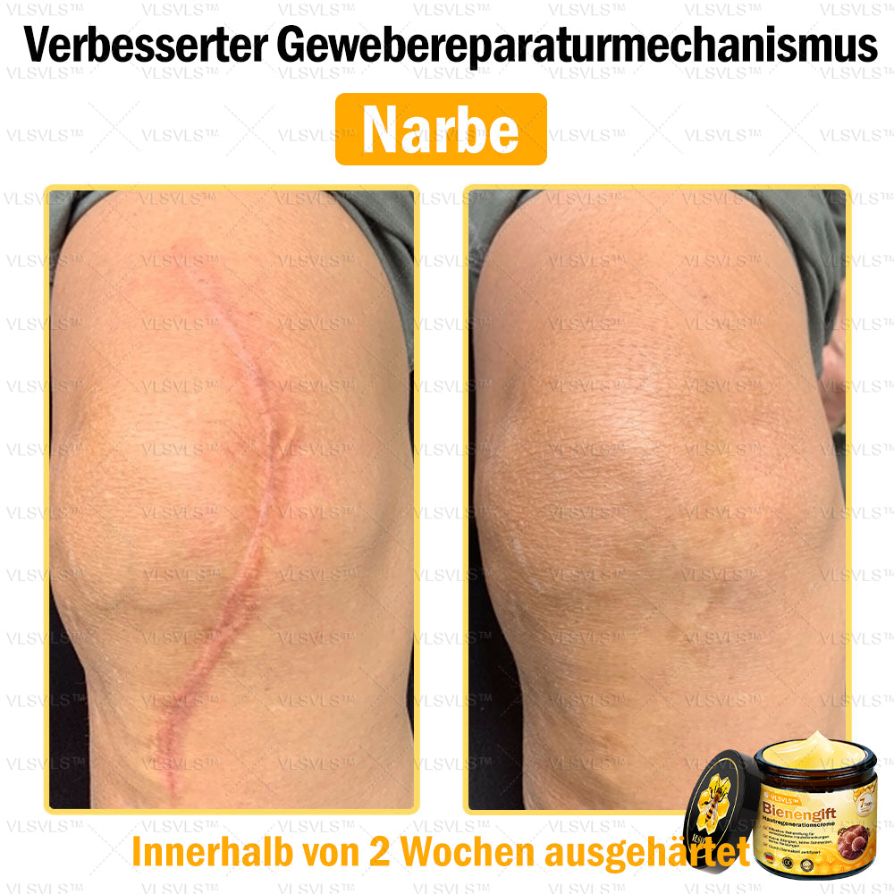 ⛄🎁 Nur noch 5 Dosen auf Lager! Wir bieten Ihnen zusätzlich 30 % Rabatt an! Bringen Sie sich in Form und bleiben Sie gesund. Wenn Sie jetzt nicht zugreifen, haben Sie erst nächstes Jahr wieder eine Chance!