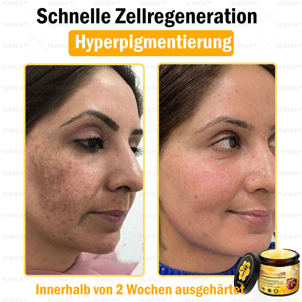 ⛄🎁 Nur noch 5 Dosen auf Lager! Wir bieten Ihnen zusätzlich 30 % Rabatt an! Bringen Sie sich in Form und bleiben Sie gesund. Wenn Sie jetzt nicht zugreifen, haben Sie erst nächstes Jahr wieder eine Chance!